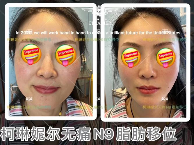 济南哪家医院治不孕不育效果好 济南哪家医院治不孕不育效果好