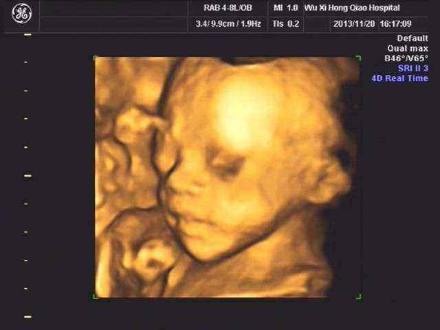 不孕不育相关专家共识 不孕不育相关专家共识