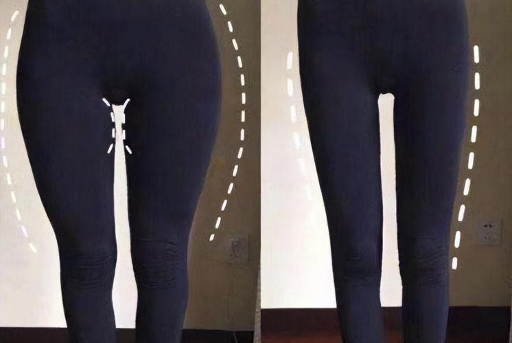 免疫性不孕是什么原因引起的 免疫性不孕换个老公就行了 免疫性不孕是什么原因引起的 免疫性不孕换个老公就行了