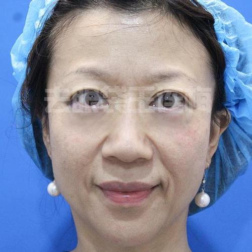 男性为什么会患上男性不育呢 男性为什么会患上男性不育呢