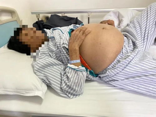 不孕不育症什么时候检查好 不孕不育症什么时候检查好