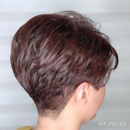 甲状腺免疫异常不孕症 甲状腺免疫异常不孕症