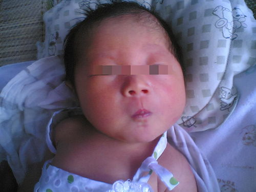 发生男性不育需要注意些什么 发生男性不育需要注意些什么