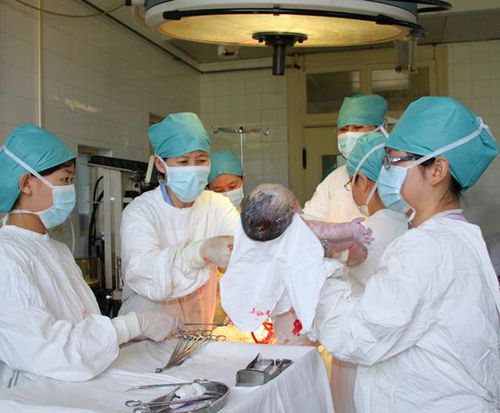 宫寒不孕怎么艾灸 宫寒不孕怎么艾灸