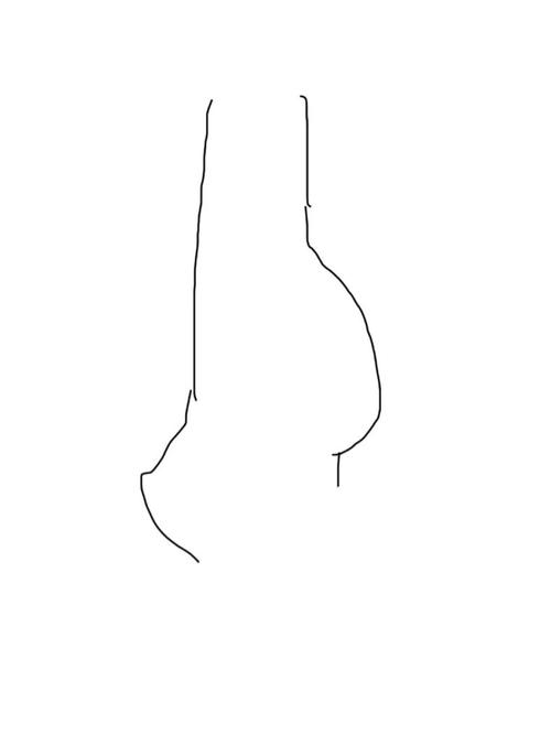 子宫性不孕不育治疗方法 子宫性不孕不育治疗方法