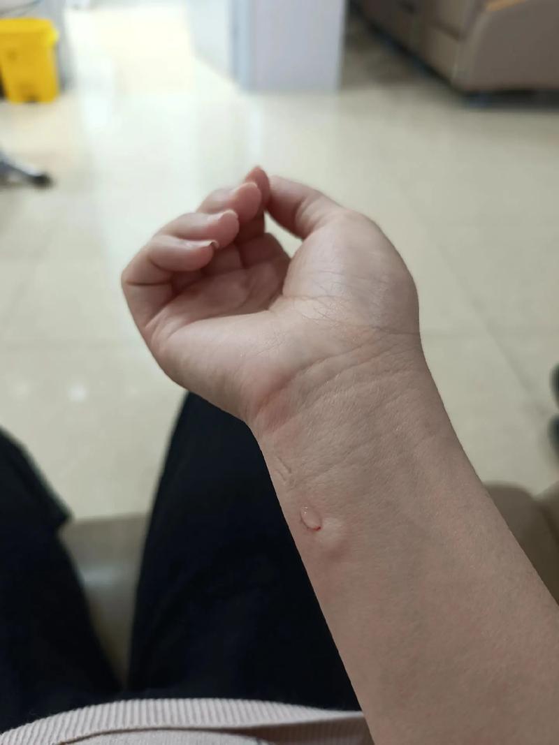 如何治疗少精症引起的男性不育 如何治疗少精症引起的男性不育