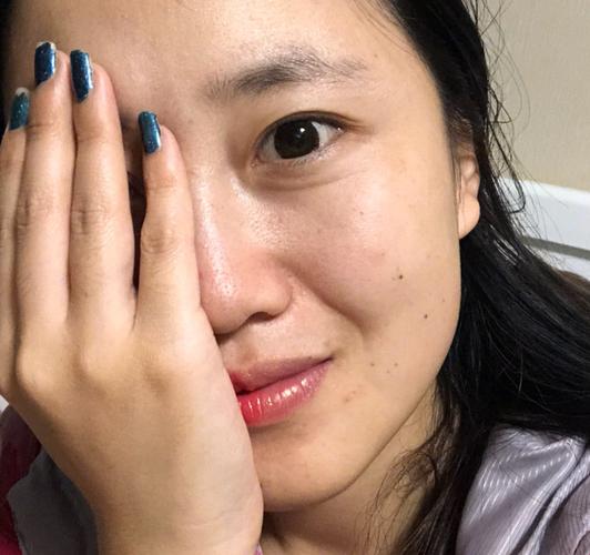 免疫性不孕诊断有四方法 检查有三项目 免疫性不孕诊断有四方法 检查有三项目