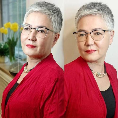 甲亢如何影响不孕及预后 甲亢如何影响不孕及预后