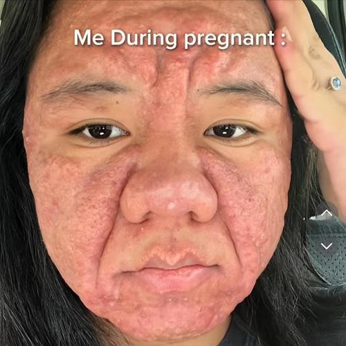 前列腺疾病会影响生育 这4种疾病可能会导致男性不育 前列腺疾病会影响生育 这4种疾病可能会导致男性不育