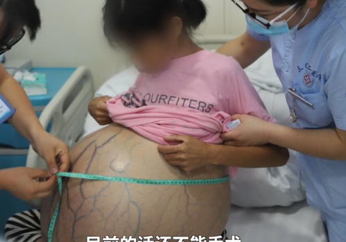 男性不育不良生活习惯是祸首 男性不育不良生活习惯是祸首