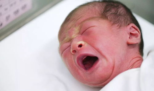 附睾炎与男性不育渊源颇深 附睾炎与男性不育渊源颇深