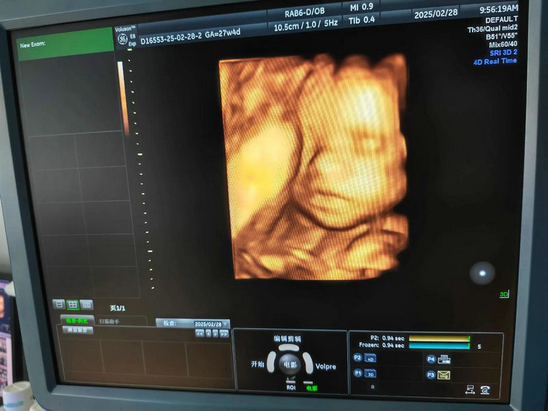 男性不孕不育症要怎样进行预防