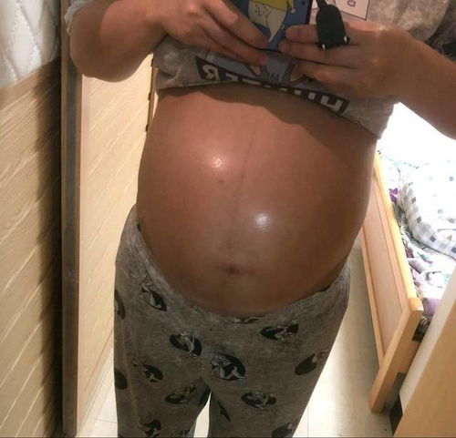 中医把不育症分为哪几种类型 中医把不育症分为哪几种类型