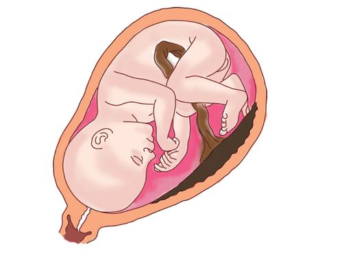 做生殖不孕需具备其本条件 梅州哪里做生殖不孕厉害 做生殖不孕需具备其本条件 梅州哪里做生殖不孕厉害