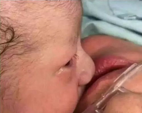 预防男性不育有哪些方法呢 预防男性不育有哪些方法呢