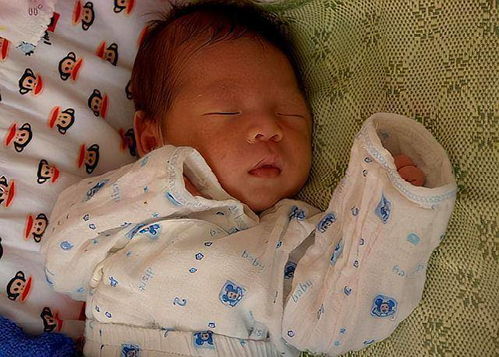 子宫内膜异位症与不孕症 子宫内膜异位症与不孕症