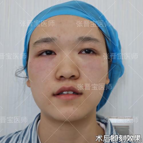 �Ͼ������Բ���������ҽԺ �侫�����׵ò��в���֢