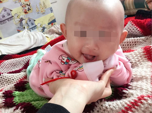 女性不孕症如何治疗 女性不孕症如何治疗