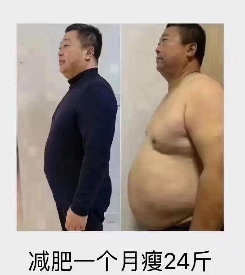 �Ͼ��ļ�ҽԺ�����Բ����� ��ĸģ�Ͷ����Բ����ķ��ӻ���