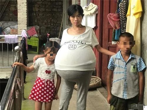 治疗不孕不育要病人心理 北京有哪些专治不孕不育的医院 治疗不孕不育要病人心理 北京有哪些专治不孕不育的医院