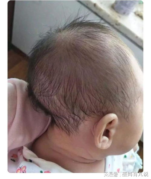 �������β��в������� ���������Բ��в�����Ҫ׼��ʲô